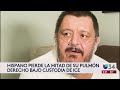 Latino dice que perdió la mitad de su pulmón estando bajo custodia de ICE: duró dos semanas en coma
