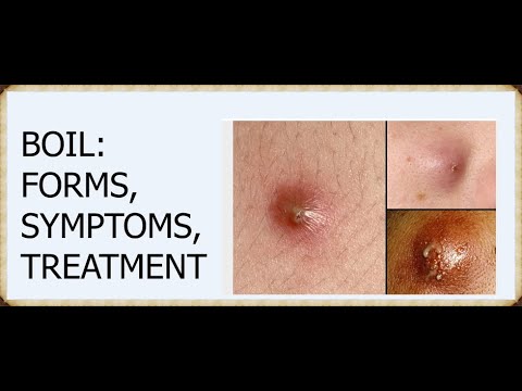 Folliculitis and furuncles  carbuncles boils