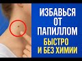 ПАПИЛЛОМЫ ИСЧЕЗНУТ ЗА 7 ДНЕЙ. КАК УБРАТЬ ПАПИЛЛОМЫ ДОМА БЕЗ ОПЕРАЦИИ