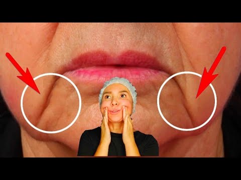 3 MASSAGE techniques to get rid of MARIONETTE LINES and lift mouth corners