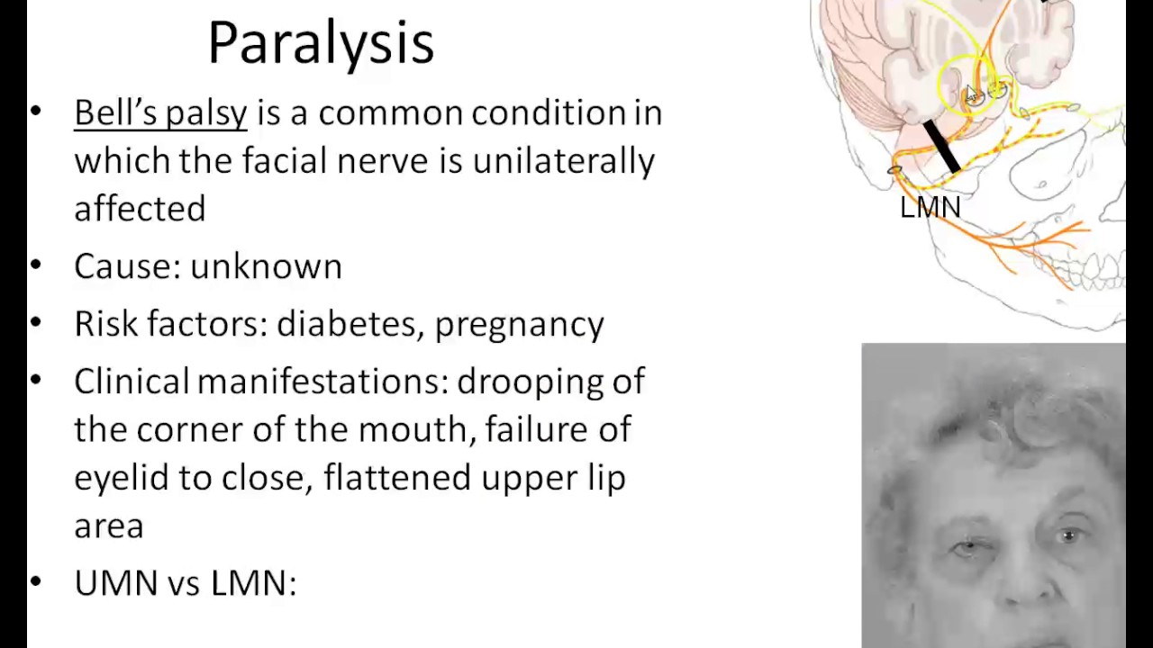 Chapter 25  PNS, Part 1