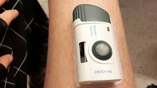 La Maladie De Crohn Mont Traitement Le Skyrizi .