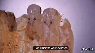 Rotten Cockroach Eggs Under the Microscope