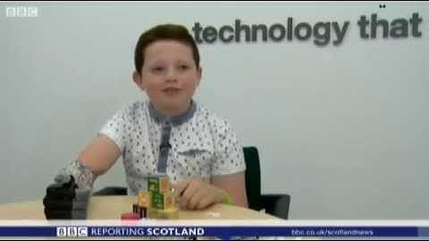 Josh Cathcart, nine, becomes youngest bionic hand wearer in UK