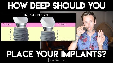 How deep should you place your implants?