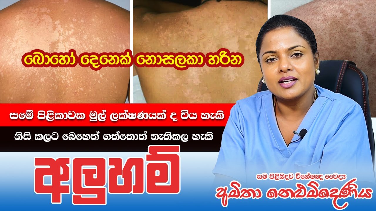 නොසලකා හැරියට වෙන ලෙඩක්ද විය හැකි අළුහම් | Skin Specialist