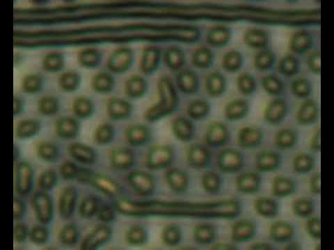 45. Light-driven dynamic Archimedes spirals and oscillatory patterns of topological solitons