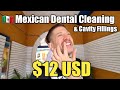 $12 MEXICAN DENTAL CLEANING (Used a SMORKEL MASK!) by Dentist "Janet" 🇲🇽 Oaxaca City, Mexico