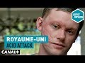 Royaume-Uni : Acid attack - L'Effet Papillon