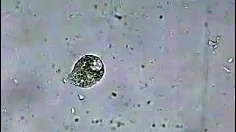 Silver Killing Bacteria Under Microscope!