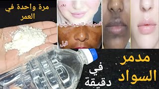 A woman in her 20s swears by a recipe from an Algerian doctor: My face was ruined by darkness and... screenshot 5