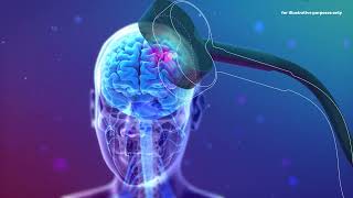Transcranial Magnetic Stimulation (TMS) | 3D MoA Scientific Visualization