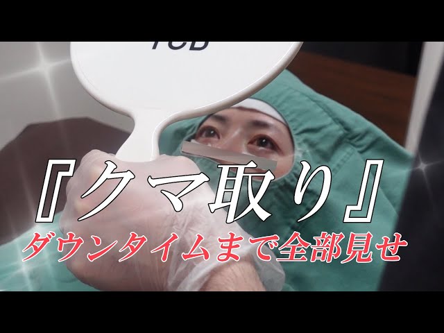 目の下のクマ取り】ついに行ってきました／ダウンタイム／3児の