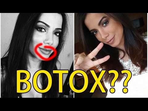 Guarda ANITTA APLICOU BOTOX? O MISTÉRIO DOS LÁBIOS DE ANITTA! su YouTube Guarda ANITTA APLICOU BOTOX? O MISTÉRIO DOS LÁBIOS DE ANITTA! su YouTube