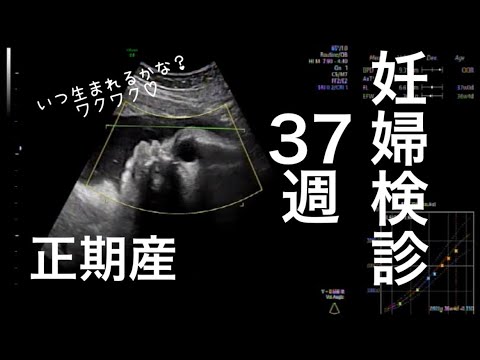 【妊婦検診】37週｜正期産突入｜予定日まで残り20日！