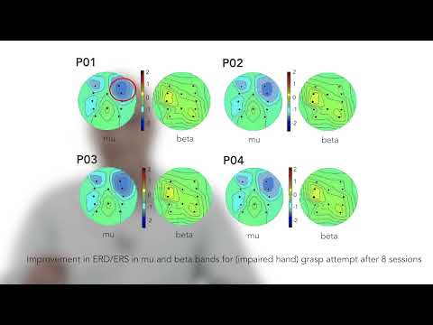 Brain Computer Interface (BCI) based hand exoskeleton for neuro-rehabilitation of stroke patients