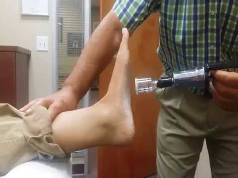 cupping therapy for plantar fasciitis