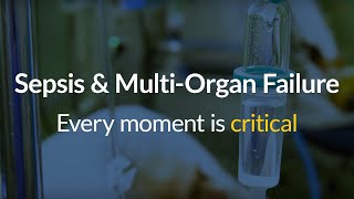 Sepsis and Multi-Organ Failure: Every Moment is Critical