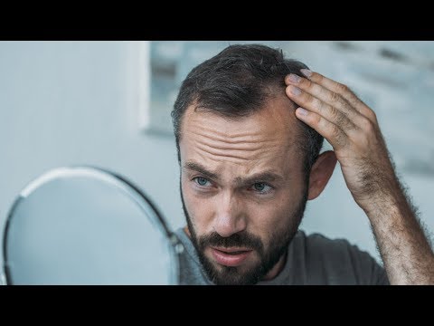 Video: Alopecia (chelie) La Bărbați - Cum Să Opriți Chelia? Preparate, șampoane