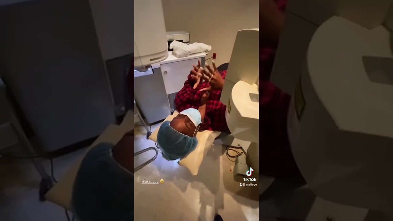 Before and after of Nevus (eye freckle) removal. 