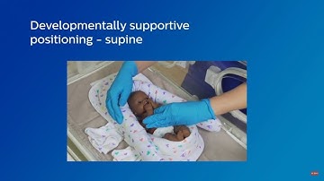 Developmentally supportive infant positioning - supine