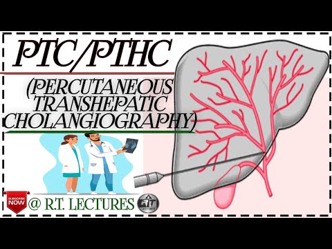 #PTC Procedure #Percutaneous Transhepatic Cholangiography Peocedure #PTHC Procedure in hindi