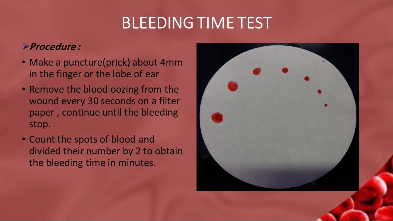7 Bleeding Time And Clotting Time YouTube 7 Bleeding Time And Clotting Time YouTube