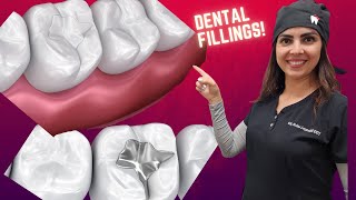 Gold vs Silver vs White Dental Fillings