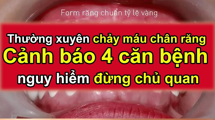 Hiện tượng chảy máu chân răng là bệnh gì