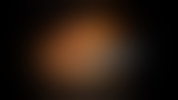 Robotic subxiphoid thymectomy (unedited)