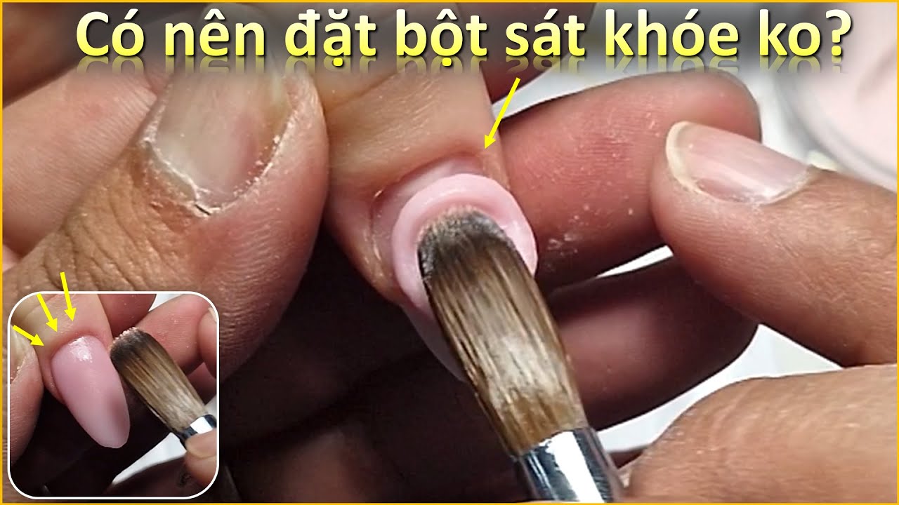 Đắp bột có đặt cục bột sát khóe không -- Điệp Nguyễn