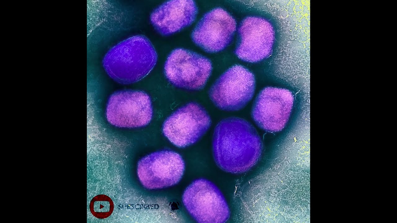 Monkeypox: should you be worried?