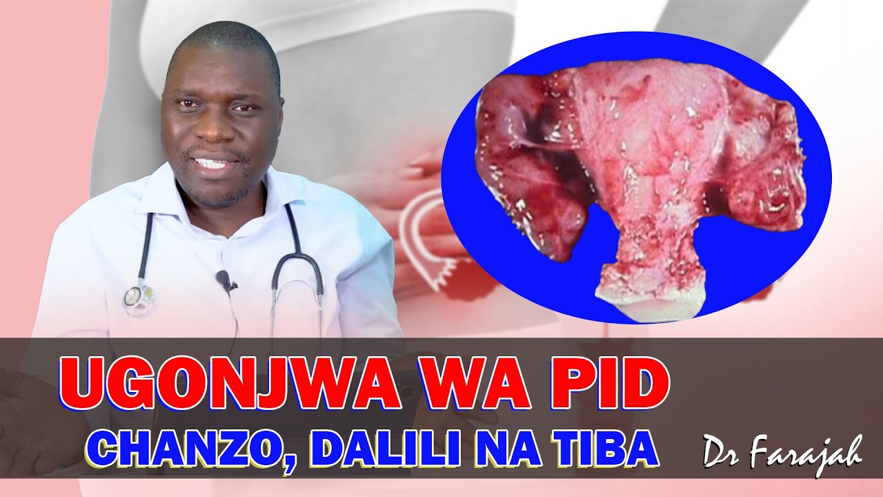 UGONJWA WA PID: CHANZO DALILI NA MATIBABU