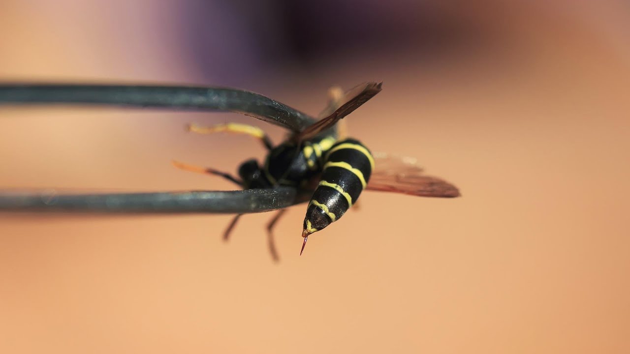 Why You Shouldn't Use Tweezers To Remove a Bee Stinger | Dr. Ian ...