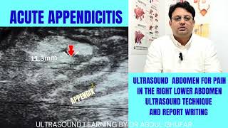 Appendix ultrasound | appendicitis ultrasound | appendix ultrasound technique | Appendix symptoms