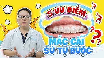 05 ƯU ĐIỂM CỦA MẮC CÀI SỨ TỰ BUỘC CÓ THỂ BẠN CHƯA BIẾT??| NIỀNG RĂNG SỨ TỰ BUỘC