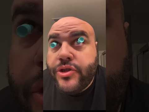 MY EYEBALL CAME OUT Vs Me