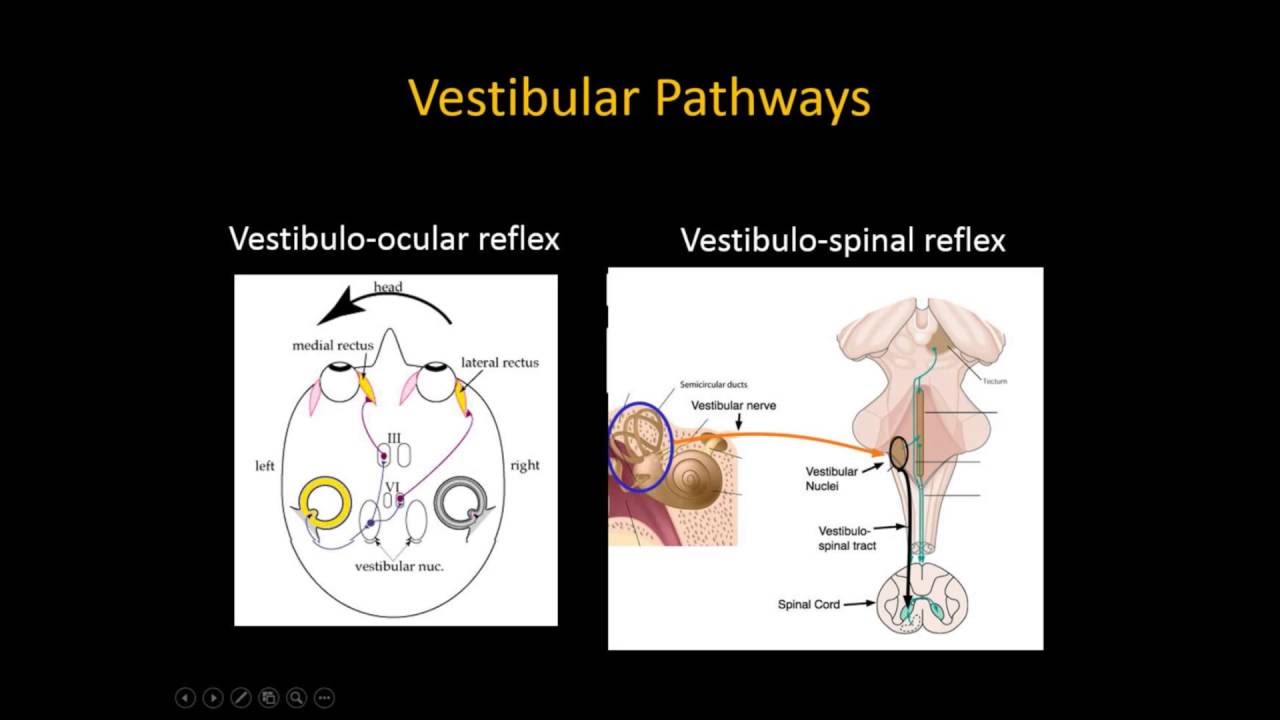 Vestibular Nerve Injury Trial Exhibit Brain Injury