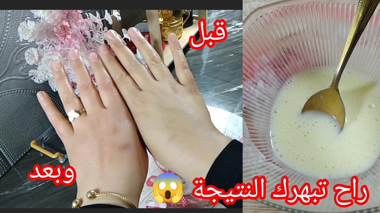 #تبييض_فوري 💯ضد التجاعيد والهالات السوداء ضد الكلف راح تخرجي عروسة نهار العيد 🥳