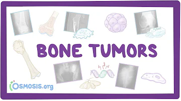 Are benign bone lesions painful?