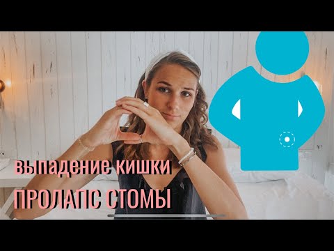 ПРОЛАПС стомы выпадение кишки