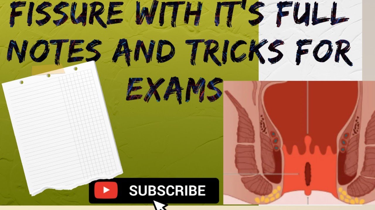 Fissureinano#shalyatantra#bams4thyr#easygoing#ayurveda