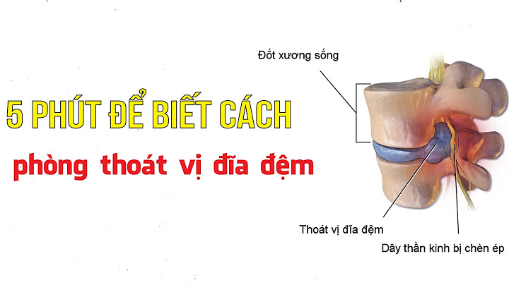 Bệnh thoát vị đĩa đệm cột sống nguyên nhân