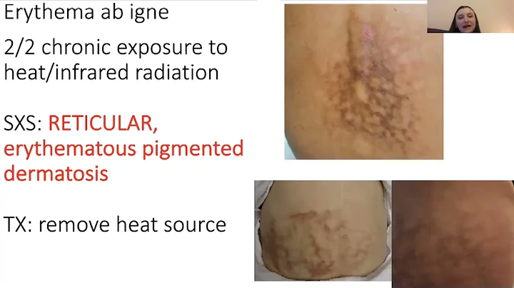 Derm Exam 3: Part 1