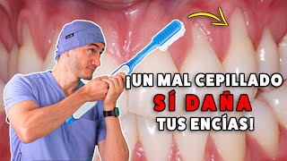 Retracción de encías por mal cepillado | Causa y solución