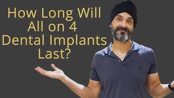 Hoe lang gaan All-on-4-implantaten of een volledige set implantaten mee?