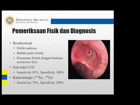 Video: Embolisme Paru Setelah Pembedahan: Ketahui Risikonya