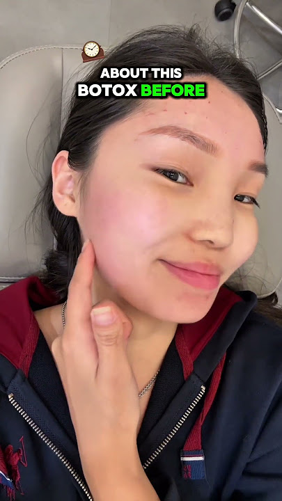 Massater botox review at Gu Clinic