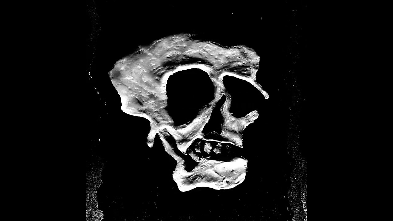 AUGEN X - 02. POISON live 2026