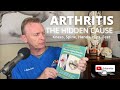 ARTHRITIS THE HIDDEN CAUSE | DR STOKES